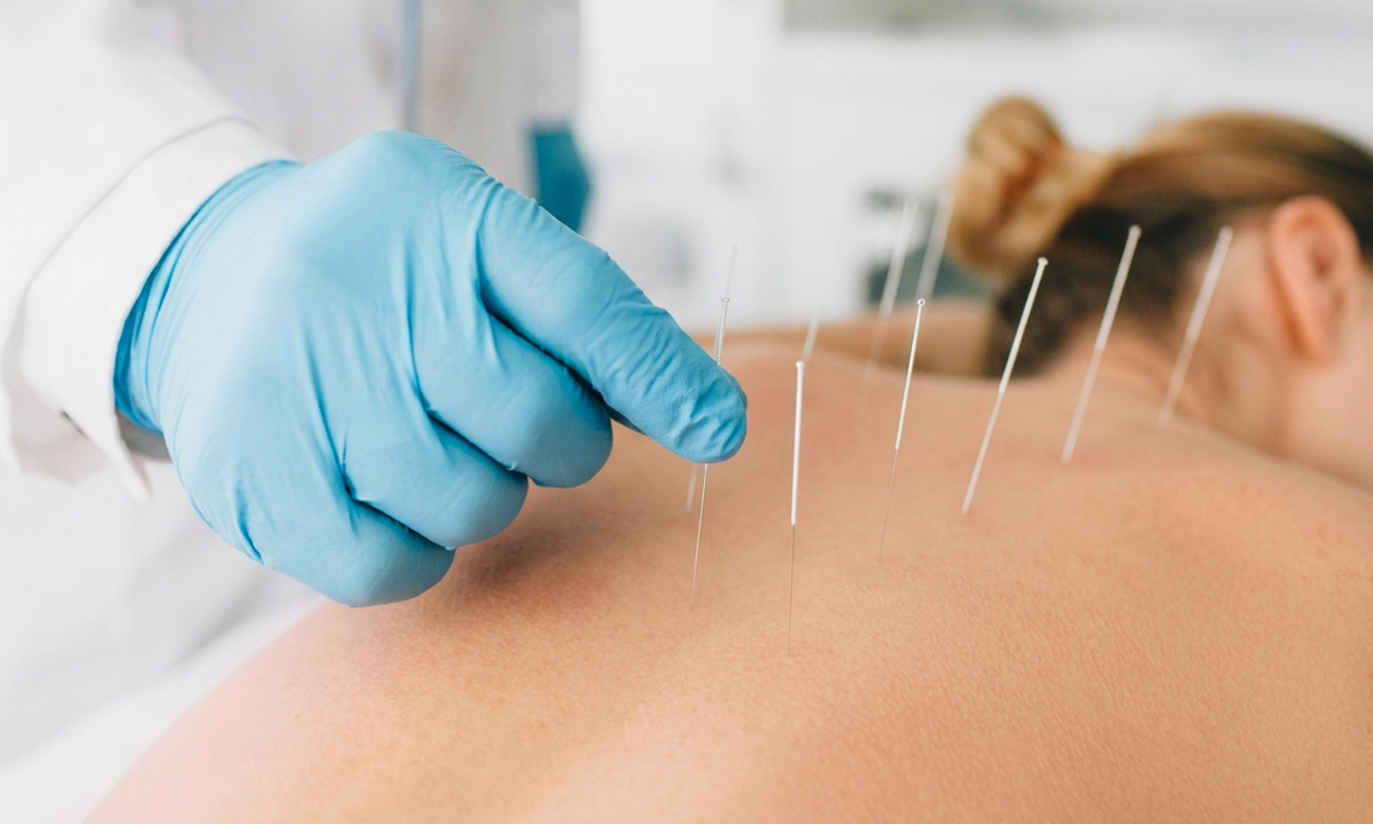 Acupunctuur Breda