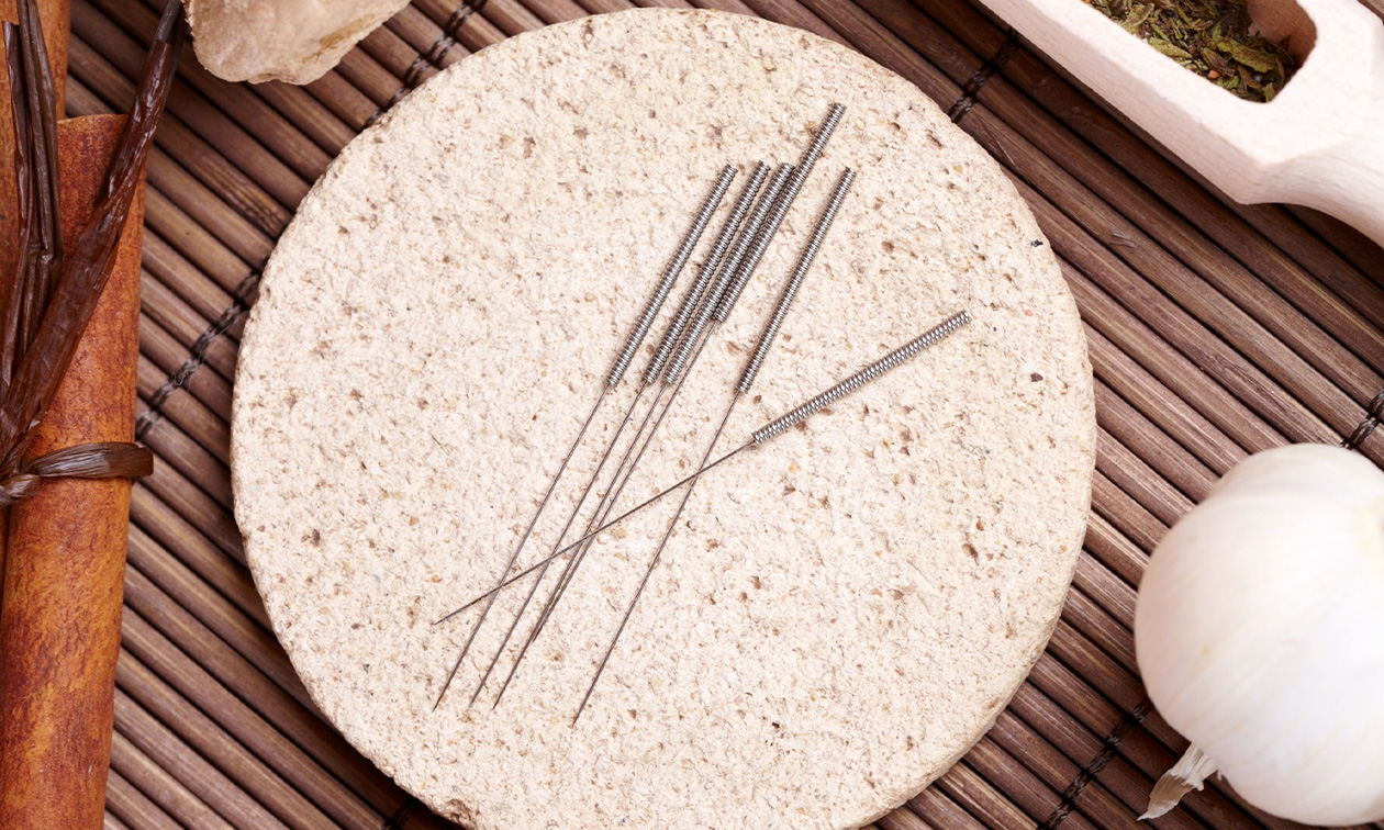 Acupunctuur4u
