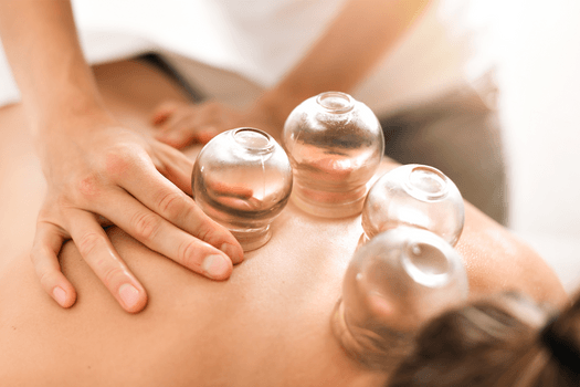 Akupunktur & cupping