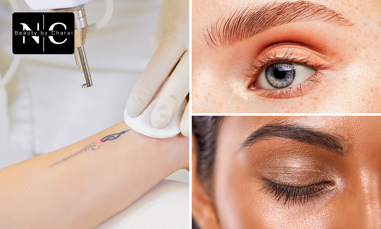 Browlamination, wimperlift of tattooverwijdering Browlamination, wimperlift of tattooverwijdering