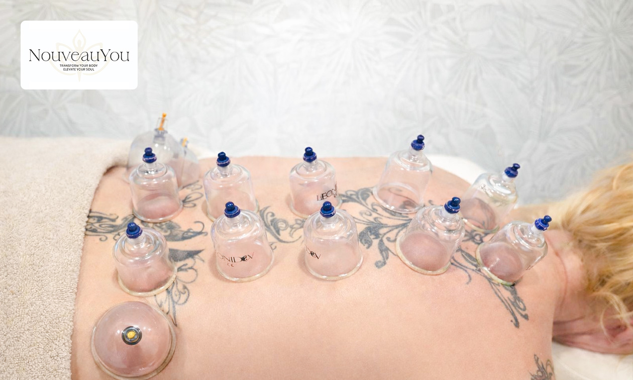 Cuppingbehandeling naar keuze (45, 60 of 90 min)